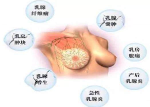 乳腺腫塊治療方式有哪些？