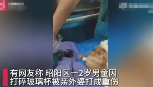 2歲男童因打碎玻璃杯遭外婆暴力毆打，生命岌岌可危